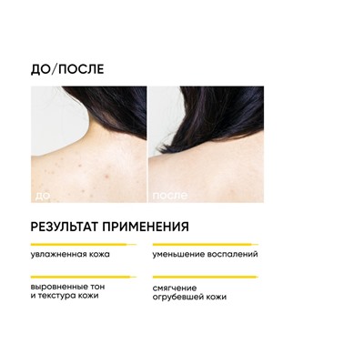 ICON SKIN Обновляющий крем для тела с кислотами SKIN RENEWAL, 200 мл Для всех типов кожи