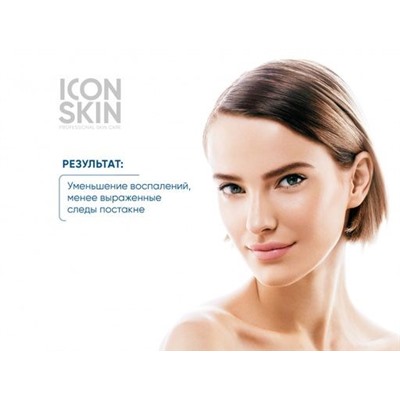 ICON SKIN Пилинг для лица с 18% комплексом кислот. Лечение тяжелой степени акне. 30 мл